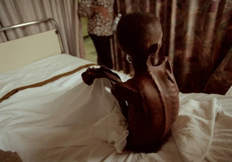 എച്ച് ഐ വി ബാധിതരുടെ എണ്ണം  കുത്തനെ കൂടുന്നു; ദിവസം 4000 പകർച്ച