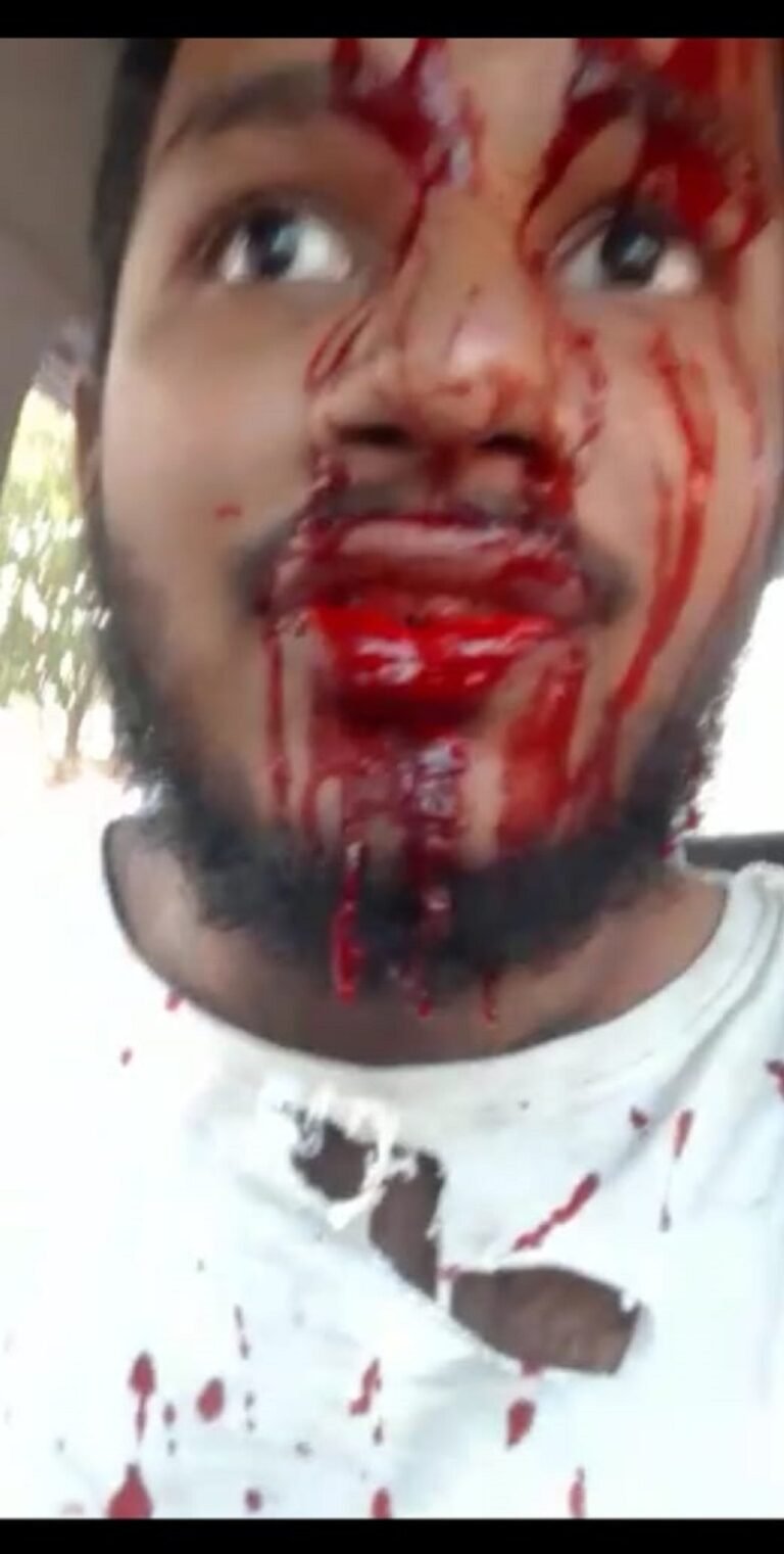 കുസാറ്റിൽ വിദ്യാർഥികൾ ഏറ്റുമുട്ടി, അഞ്ച് പേർക്ക് പരിക്ക്