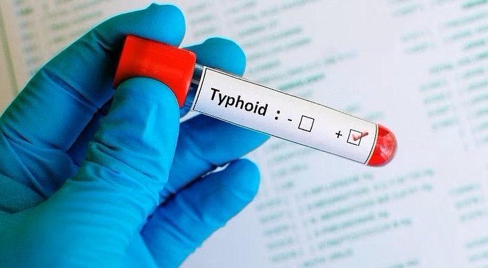 ഹോട്ടൽ ജീവനക്കാർക്ക് കുത്തിവെപ്പ് നിർബന്ധമാക്കി, മരുന്നു പൂഴ്ത്തി കൊള്ളയടിക്കാൻ കമ്പനികൾ; വില 165 ൽ നിന്ന് രണ്ടായിരത്തിലേക്ക്