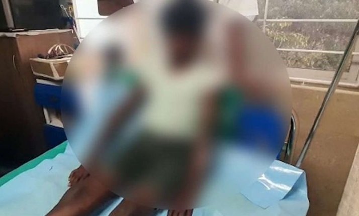 ഏഴു വയസ്സുകാരനെ പൊള്ളിച്ചു, കണ്ണിൽ മുളക് വിതറി, അമ്മ അറസ്റ്റിൽ