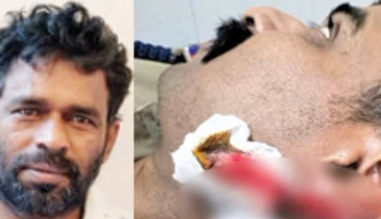 മദ്യലഹരിയിൽ വിളയാടിയ യുവാവ് പൊലീസ് ജീപ്പിൽ എസ് ഐയുടെ ചെവി കടിച്ചു മുറിച്ചു