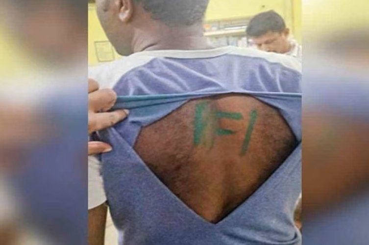 സൈനികൻ്റെ പുറത്ത് പിഎഫ്ഐ ചാപ്പ കുത്തിയ സംഭവം ആസൂത്രിത നാടകം, മൊഴിയിലെ ദുരൂഹത നീങ്ങിയില്ല