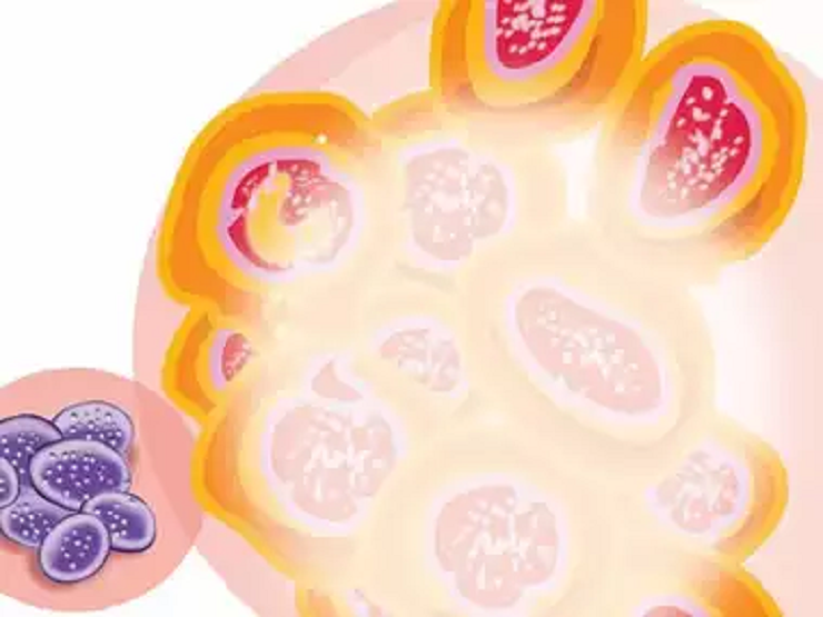 സമ്പർക്ക പട്ടികയിൽ 75 പേർ, ചികിത്സയിലുള്ളത് രണ്ട് കുഞ്ഞുങ്ങൾ ഉൾപ്പെടെ നാല് പേർ